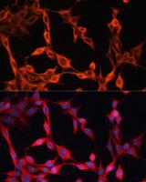 SLC25A23 Antibody - Immunofluorescence analysis of NIH/3T3 cells using SLC25A23 Polyclonal Antibody at dilution of 1:100.Blue: DAPI for nuclear staining.