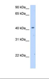SLC25A24 / APC1 Antibody - Fetal Thymus cell lysate. Antibody concentration: 2.5 ug/ml. Gel concentration: 12%.  This image was taken for the unconjugated form of this product. Other forms have not been tested.
