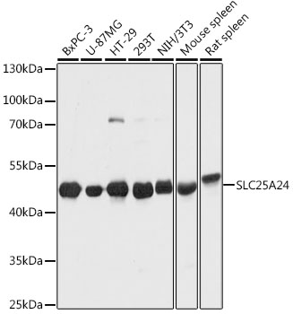 SLC25A24 / APC1 Antibody - Western blot analysis of extracts of various cell lines, using SLC25A24 antibody at 1:1000 dilution. The secondary antibody used was an HRP Goat Anti-Rabbit IgG (H+L) at 1:10000 dilution. Lysates were loaded 25ug per lane and 3% nonfat dry milk in TBST was used for blocking. An ECL Kit was used for detection and the exposure time was 1s.
