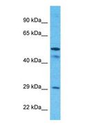 SLC25A24 / APC1 Antibody - Western blot of SCMC1 Antibody with human MCF7 Whole Cell lysate.  This image was taken for the unconjugated form of this product. Other forms have not been tested.
