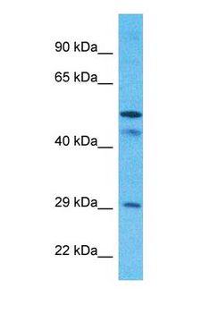 SLC25A24 / APC1 Antibody - Western blot of SCMC1 Antibody with human MCF7 Whole Cell lysate.  This image was taken for the unconjugated form of this product. Other forms have not been tested.