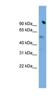 SLC25A25 Antibody - SLC25A25 antibody Western blot of HepG2 cell lysate. This image was taken for the unconjugated form of this product. Other forms have not been tested.
