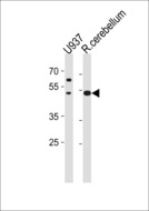 SLC25A25 Antibody - SLC25A25 Antibody western blot of U-937 cell line and rat cerebellum tissue lysates (35 ug/lane). The SLC25A25 antibody detected the SLC25A25 protein (arrow).
