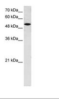 SLC25A25 Antibody - HepG2 Cell Lysate.  This image was taken for the unconjugated form of this product. Other forms have not been tested.