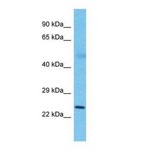 SLC25A26 Antibody - Western blot of Human Lung Tumor. SLC25A26 antibody dilution 1.0 ug/ml.  This image was taken for the unconjugated form of this product. Other forms have not been tested.