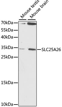SLC25A26 Antibody - Western blot analysis of extracts of various cell lines, using SLC25A26 antibody at 1:1000 dilution. The secondary antibody used was an HRP Goat Anti-Rabbit IgG (H+L) at 1:10000 dilution. Lysates were loaded 25ug per lane and 3% nonfat dry milk in TBST was used for blocking. An ECL Kit was used for detection and the exposure time was 90S.