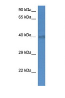 SLC25A27 / UCP4 Antibody - SLC25A27 / UCP4 antibody Western blot of Mouse Brain lysate. Antibody concentration 1 ug/ml. This image was taken for the unconjugated form of this product. Other forms have not been tested.