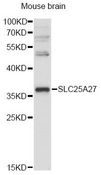 SLC25A27 / UCP4 Antibody - Western blot analysis of extracts of mouse brain, using SLC25A27 Antibody at 1:3000 dilution. The secondary antibody used was an HRP Goat Anti-Rabbit IgG (H+L) at 1:10000 dilution. Lysates were loaded 25ug per lane and 3% nonfat dry milk in TBST was used for blocking. An ECL Kit was used for detection and the exposure time was 30s.