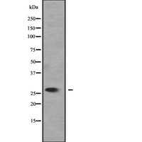 SLC25A27 / UCP4 Antibody - Western blot analysis of SLC25A27 expression in 293T cells lysate. The lane on the left is treated with the antigen-specific peptide.