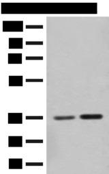 SLC25A27 / UCP4 Antibody - Western blot analysis of Mouse brain tissue and Rat brain tissue lysates  using SLC25A27 Polyclonal Antibody at dilution of 1:350
