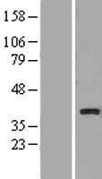 SLC25A27 / UCP4 Protein - Western validation with an anti-DDK antibody * L: Control HEK293 lysate R: Over-expression lysate