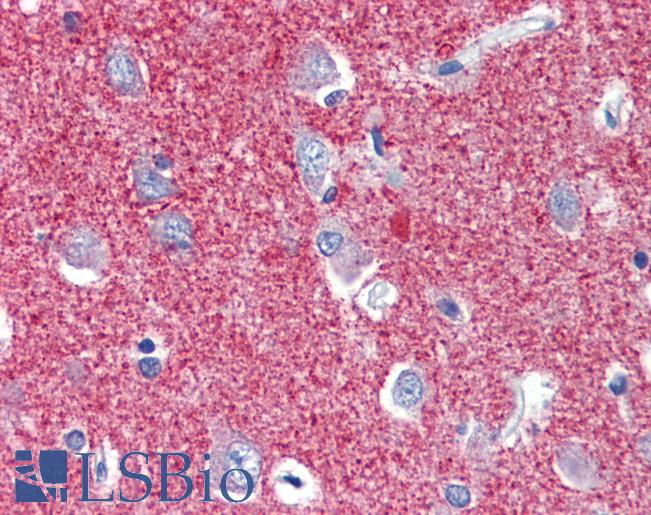 SLC25A28 Antibody - Anti-SLC25A28 antibody IHC of human brain, cortex. Immunohistochemistry of formalin-fixed, paraffin-embedded tissue after heat-induced antigen retrieval. Antibody concentration 5 ug/ml.  This image was taken for the unconjugated form of this product. Other forms have not been tested.