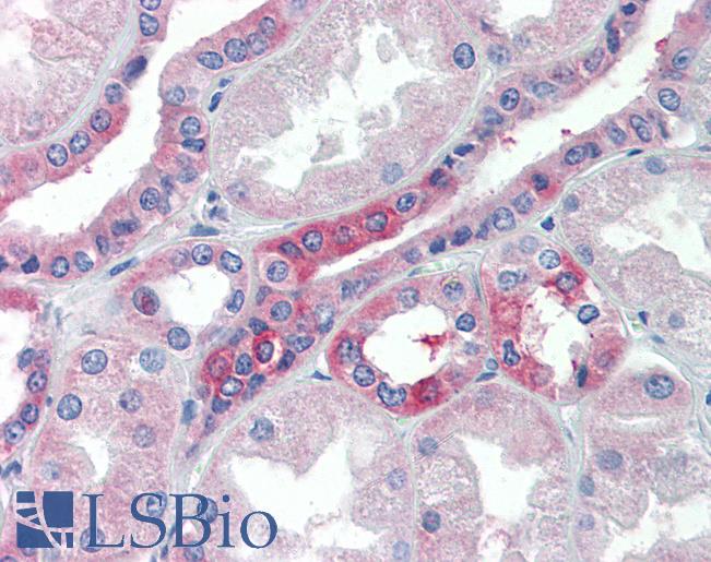 SLC25A28 Antibody - Anti-SLC25A28 antibody IHC of human kidney. Immunohistochemistry of formalin-fixed, paraffin-embedded tissue after heat-induced antigen retrieval. Antibody concentration 5 ug/ml.  This image was taken for the unconjugated form of this product. Other forms have not been tested.