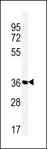 SLC25A28 Antibody - Western blot of MFRN2 Antibody in Jurkat cell line lysates (35 ug/lane). MFRN2 (arrow) was detected using the purified antibody.