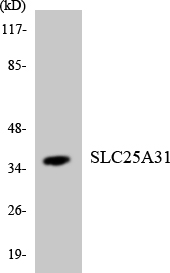 SLC25A31 Antibody - Western blot analysis of the lysates from K562 cells using SLC25A31 antibody.