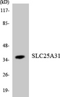 SLC25A31 Antibody - Western blot analysis of the lysates from K562 cells using SLC25A31 antibody.
