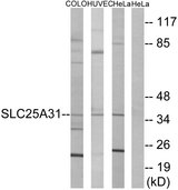 SLC25A31 Antibody - Western blot analysis of lysates from HeLa, HUVEC, and COLO cells, using SLC25A31 Antibody. The lane on the right is blocked with the synthesized peptide.