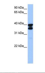 SLC25A31 Antibody - Fetal brain lysate. Antibody concentration: 1.0 ug/ml. Gel concentration: 12%.  This image was taken for the unconjugated form of this product. Other forms have not been tested.