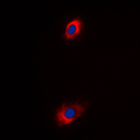 SLC25A31 Antibody - Immunofluorescent analysis of ANT4 staining in K562 cells. Formalin-fixed cells were permeabilized with 0.1% Triton X-100 in TBS for 5-10 minutes and blocked with 3% BSA-PBS for 30 minutes at room temperature. Cells were probed with the primary antibody in 3% BSA-PBS and incubated overnight at 4 C in a humidified chamber. Cells were washed with PBST and incubated with a DyLight 594-conjugated secondary antibody (red) in PBS at room temperature in the dark. DAPI was used to stain the cell nuclei (blue).