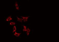 SLC25A31 Antibody - Staining HeLa cells by IF/ICC. The samples were fixed with PFA and permeabilized in 0.1% Triton X-100, then blocked in 10% serum for 45 min at 25°C. The primary antibody was diluted at 1:200 and incubated with the sample for 1 hour at 37°C. An Alexa Fluor 594 conjugated goat anti-rabbit IgG (H+L) Ab, diluted at 1/600, was used as the secondary antibody.