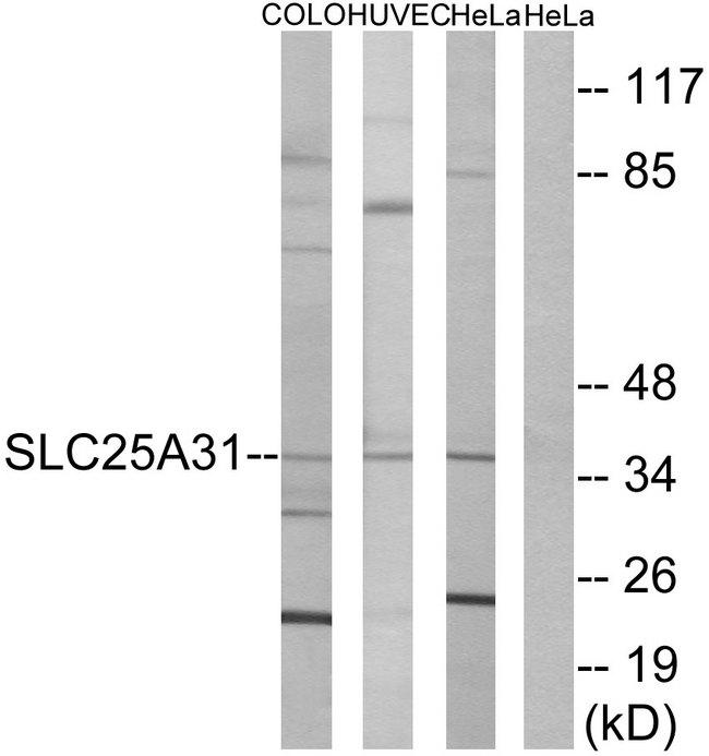 SLC25A31 Antibody - Western blot analysis of extracts from COLO cells, HUVEC cells and HeLa cells, using SLC25A31 antibody.