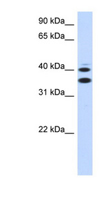 SLC25A32 Antibody - SLC25A32 antibody Western blot of Transfected 293T cell lysate. This image was taken for the unconjugated form of this product. Other forms have not been tested.