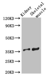 SLC25A32 Antibody - Western Blot Positive WB detected in: Mouse kidney tissue, Mouse skeletal muscle tissue All lanes: SLC25A32 antibody at 3µg/ml Secondary Goat polyclonal to rabbit IgG at 1/50000 dilution Predicted band size: 36 kDa Observed band size: 36 kDa
