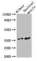 SLC25A32 Antibody - Western Blot Positive WB detected in: Mouse kidney tissue, Mouse skeletal muscle tissue All lanes: SLC25A32 antibody at 3µg/ml Secondary Goat polyclonal to rabbit IgG at 1/50000 dilution Predicted band size: 36 kDa Observed band size: 36 kDa