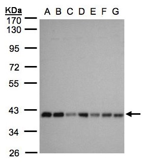 SLC25A33 Antibody - Sample (30 ug whole cell lysate). A:293T, B: A431 , C: H1299, D: HeLa S3 , E: Hep G2 . F: MOLT4 . G: Raji . 10% SDS PAGE. SLC25A33 antibody diluted at 1:1000