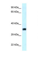 SLC25A33 Antibody - SLC25A33 antibody Western blot of ACHN Cell lysate. Antibody concentration 1 ug/ml.  This image was taken for the unconjugated form of this product. Other forms have not been tested.