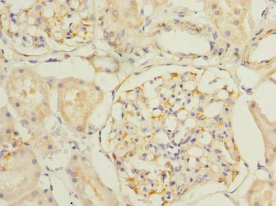 SLC25A33 Antibody - Immunohistochemistry of paraffin-embedded human kidney tissue using antibody at dilution of 1:100.