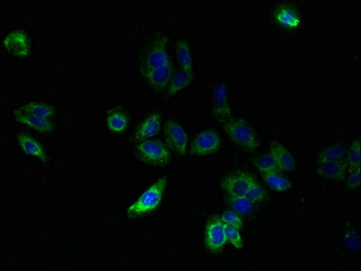 SLC25A33 Antibody - Immunofluorescent analysis of HepG2 cells using SLC25A33 Antibody at dilution of 1:100 and Alexa Fluor 488-congugated AffiniPure Goat Anti-Rabbit IgG(H+L)
