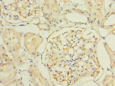 SLC25A33 Antibody - Immunohistochemistry of paraffin-embedded human kidney tissue using SLC25A33 Antibody at dilution of 1:100