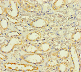 SLC25A35 Antibody - Immunohistochemistry of paraffin-embedded human kidney tissue using SLC25A35 Antibody at dilution of 1:100