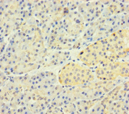 SLC25A35 Antibody - Immunohistochemistry of paraffin-embedded human pancreatic tissue using SLC25A35 Antibody at dilution of 1:100