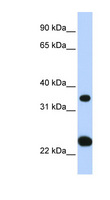 SLC25A35 Antibody - SLC25A35 antibody Western blot of Fetal Liver lysate. This image was taken for the unconjugated form of this product. Other forms have not been tested.