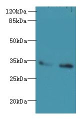 SLC25A36 Antibody - Western blot. All lanes: SLC25A36 antibody at 4 ug/ml. Lane 1: A431 whole cell lysate. Lane 2: A549 whole cell lysate. Secondary Goat polyclonal to Rabbit IgG at 1:10000 dilution. Predicted band size: 34 kDa. Observed band size: 34 kDa.