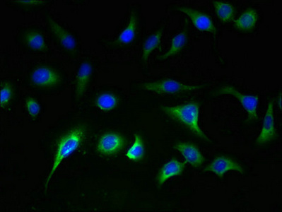 SLC25A36 Antibody - Immunofluorescent analysis of A549 cells using SLC25A36 Antibody at dilution of 1:100 and Alexa Fluor 488-congugated AffiniPure Goat Anti-Rabbit IgG(H+L)