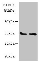 SLC25A36 Antibody - Western blot All lanes: SLC25A36 antibody at 4µg/ml Lane 1: A431 whole cell lysate Lane 2: A549 whole cell lysate Secondary Goat polyclonal to rabbit IgG at 1/10000 dilution Predicted band size: 35, 15, 18 kDa Observed band size: 35 kDa
