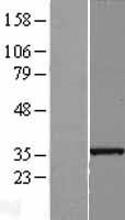 SLC25A36 Protein - Western validation with an anti-DDK antibody * L: Control HEK293 lysate R: Over-expression lysate