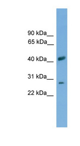 SLC25A37 / Mitoferrin Antibody - SLC25A37 antibody Western blot of THP-1 cell lysate.
