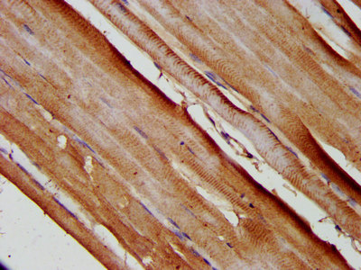 SLC25A37 / Mitoferrin Antibody - Immunohistochemistry image at a dilution of 1:200 and staining in paraffin-embedded human skeletal muscle tissue performed on a Leica BondTM system. After dewaxing and hydration, antigen retrieval was mediated by high pressure in a citrate buffer (pH 6.0) . Section was blocked with 10% normal goat serum 30min at RT. Then primary antibody (1% BSA) was incubated at 4 °C overnight. The primary is detected by a biotinylated secondary antibody and visualized using an HRP conjugated SP system.