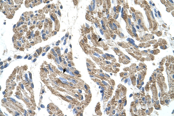 SLC25A38 Antibody - SLC25A38 antibody ARP43978_P050-NP_060345-SLC25A38(solute carrier family 25, member 38) Antibody IHC of formalin-fixed, paraffin-embedded human Muscle. Positive label: Skeletal muscle cells indicated with arrows. Antibody concentration 4-8 ug/ml. Magnification 400X.  This image was taken for the unconjugated form of this product. Other forms have not been tested.