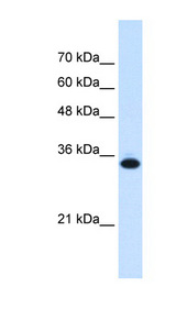 SLC25A38 Antibody - SLC25A38 antibody ARP43978_P050-NP_060345-SLC25A38(solute carrier family 25, member 38) Antibody Western blot of Jurkat lysate.  This image was taken for the unconjugated form of this product. Other forms have not been tested.