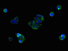 SLC25A38 Antibody - Immunofluorescent analysis of MCF-7 cells using SLC25A38 Antibody at dilution of 1:100 and Alexa Fluor 488-congugated AffiniPure Goat Anti-Rabbit IgG(H+L)