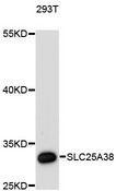 SLC25A38 Antibody - Western blot analysis of extracts of 293T cells, using SLC25A38 antibody at 1:3000 dilution. The secondary antibody used was an HRP Goat Anti-Rabbit IgG (H+L) at 1:10000 dilution. Lysates were loaded 25ug per lane and 3% nonfat dry milk in TBST was used for blocking. An ECL Kit was used for detection and the exposure time was 90s.