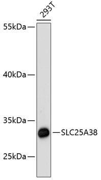 SLC25A38 Antibody - Western blot analysis of extracts of 293T cells using SLC25A38 Polyclonal Antibody at dilution of 1:3000.