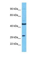SLC25A38 Antibody - Western blot of S2538 Antibody with human MCF7 Whole Cell lysate.  This image was taken for the unconjugated form of this product. Other forms have not been tested.