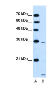 SLC25A39 Antibody - SLC25A39 antibody ARP43962_P050-NP_057100-SLC25A39(solute carrier family 25, member 39) Antibody Western blot of HepG2 cell lysate.  This image was taken for the unconjugated form of this product. Other forms have not been tested.