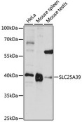 SLC25A39 Antibody - Western blot analysis of extracts of various cell lines, using SLC25A39 antibody at 1:1000 dilution. The secondary antibody used was an HRP Goat Anti-Rabbit IgG (H+L) at 1:10000 dilution. Lysates were loaded 25ug per lane and 3% nonfat dry milk in TBST was used for blocking. An ECL Kit was used for detection and the exposure time was 5s.